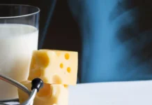 De calcium-paradox Röntgen foto van botten met op voorgrond een glas melk en blokje kaas